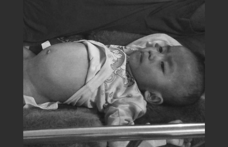 Sandi, bayi berumur 1 tahun 1 bulan, warga Bone Balantak, Kecamatan Batui Selatan menderita pembengkakan pada kelamin testis dan di ikuti penyakit lainya yaitu infeksi usus, paru-paru kotor dan hernia. Ia membutuhkan uluran tangan dari semua pihak untuk menjalani operasi.